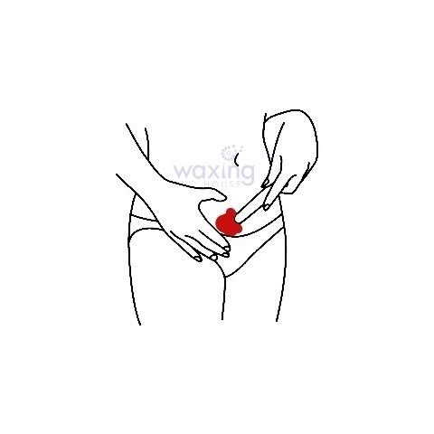 Wax lông vùng kín tại nhà đúng cách